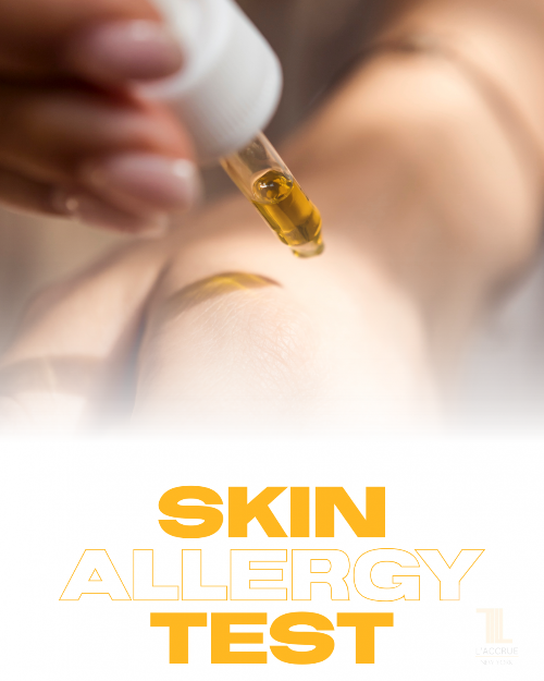 Simple Skin Allergy Test